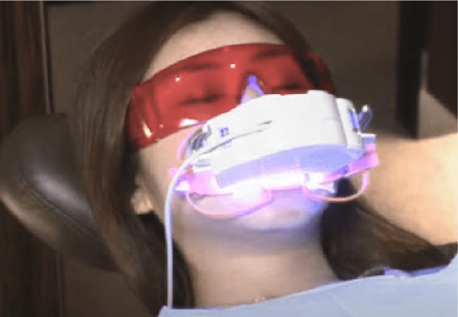 光照射器装着＆照射