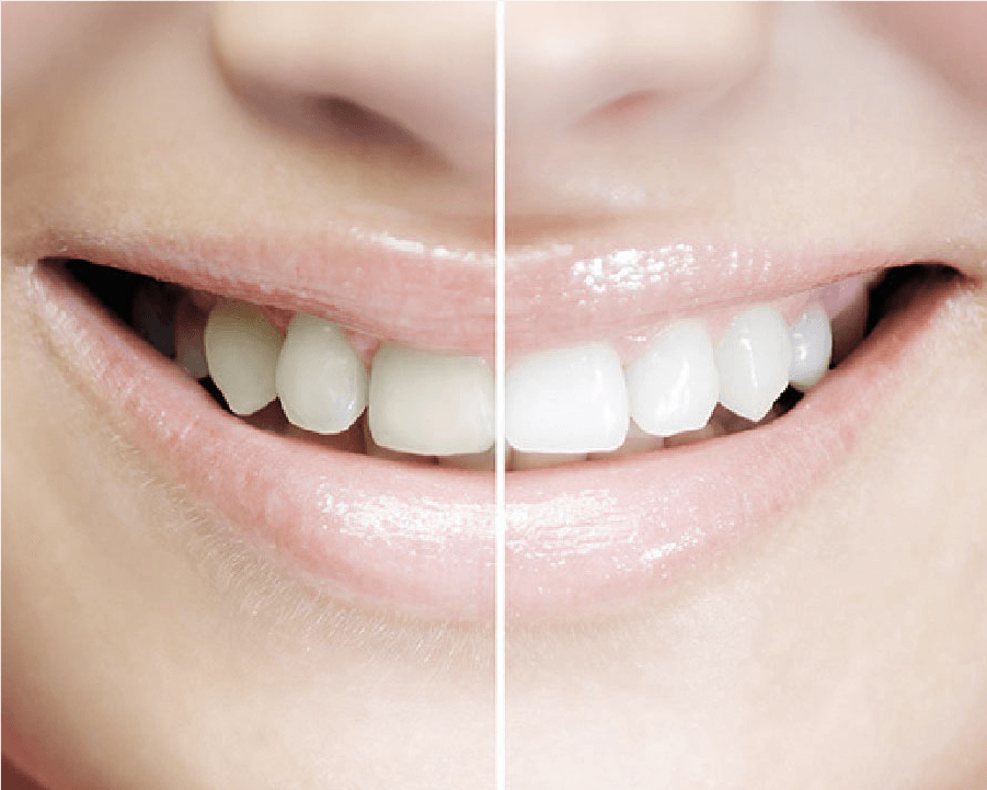 特徴1のイメージ画像