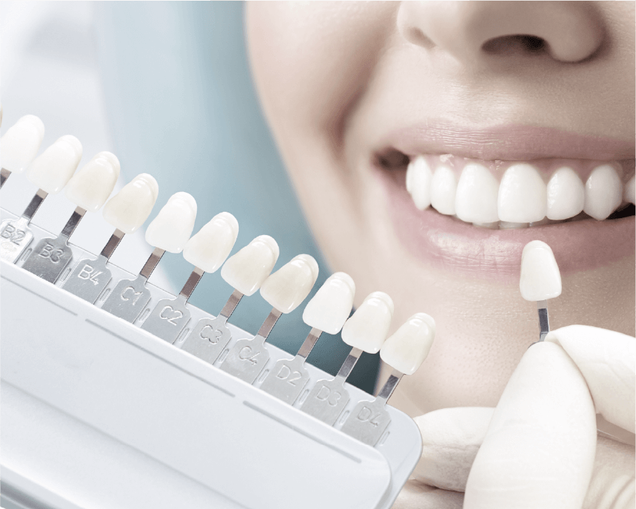 特徴2のイメージ画像