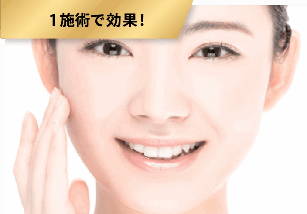 1施術で効果！