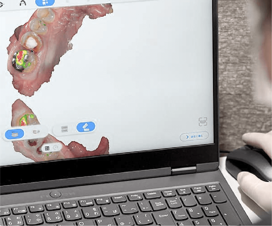 3Dスキャンの様子