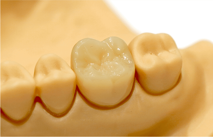 ハイブリッドセラミック