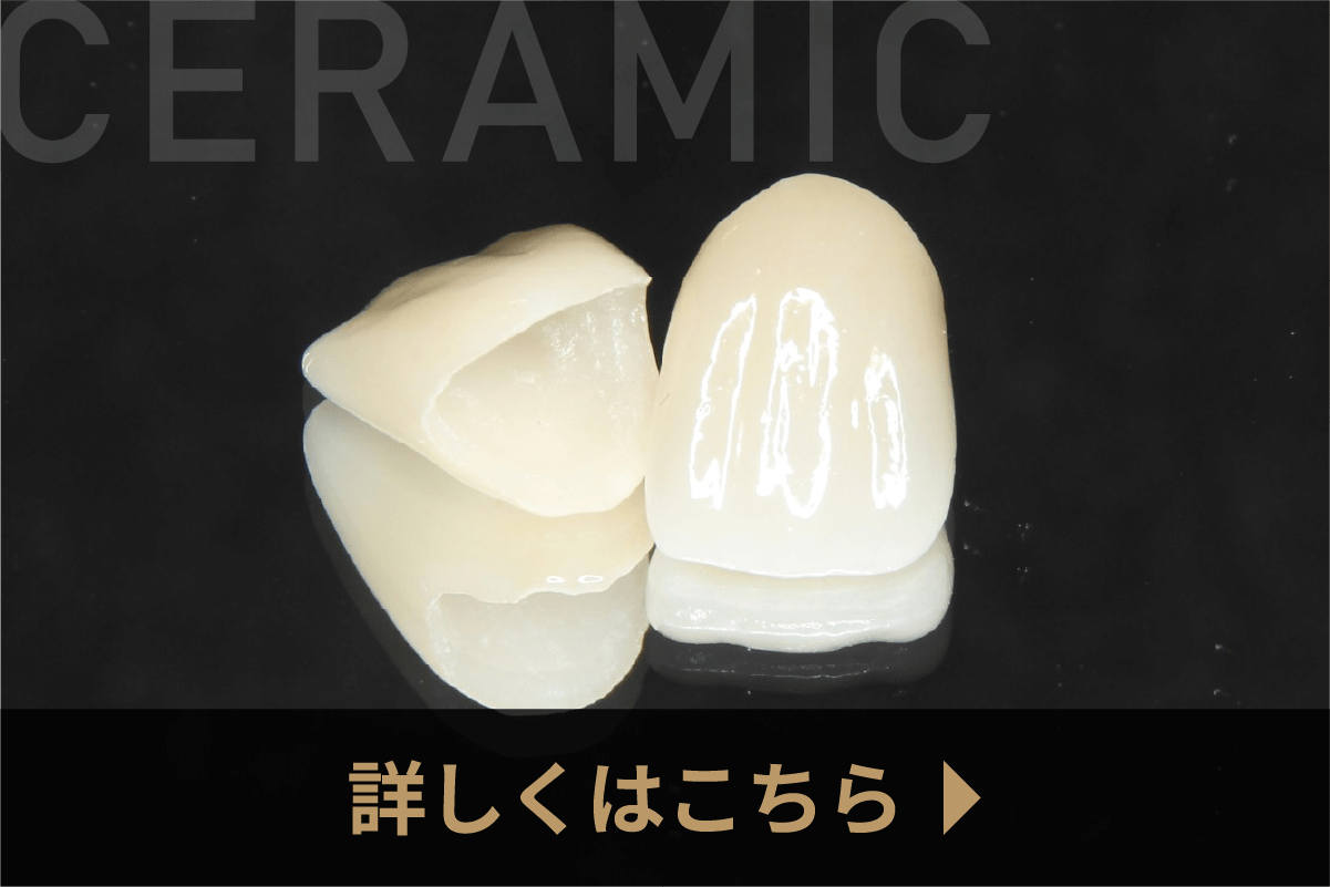 【セラミックメニュー】詳しくはこちら